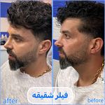 برفین اسکین