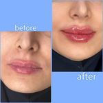 برفین اسکین