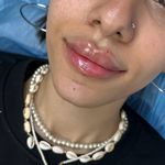 برفین اسکین