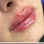 برفین اسکین