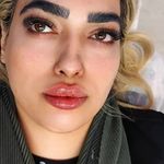 برفین اسکین