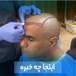 کلینیک کاشت مو و ابرو الماس در تبریز