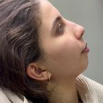 کلینیک تخصصی لیزر پوست مو زیبایی آی‌تا
