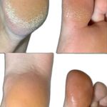 خدمات تخصصی پدیکور درمانی شیوا