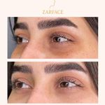 کلینیک تزریق فیلر و بوتاکس زرفیس