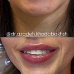 مطب زیبایی آرا