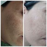 فیشال و پاکسازی شیرین نصیری درمالند