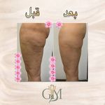 مرکز تخصصی لاغری گل مریم
