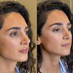 کلینیک لاغری، لیزر، پوست، مو لَوی