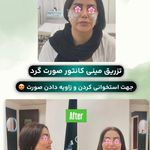 کلینیک پوست و مو و لیزر نیلوفر آبی