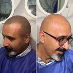 اولین مرکز میکرواسکالپ مشهد تاپ اسکالپ