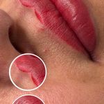 میکروکیماسی( میکروابرو چشم لب،ریمو)