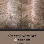 مژده