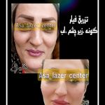 مرکزکلینیک لیزر زیبایی پوست و مو آسا