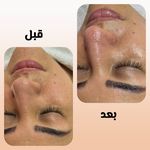 مرکز لیزر و فیشال دکتر خالقیان