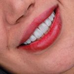 مطب دندانپزشکی زیبایی دکتر مانديس صدر