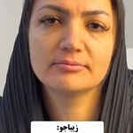 کلینیک زیبایی شایلی