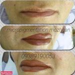 مرکز تخصصی میکرو پیگمنتیشن