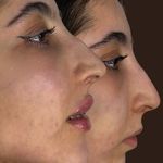 کلینیک زیبایی قهرمانی