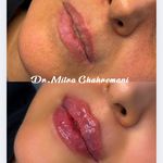 کلینیک زیبایی قهرمانی