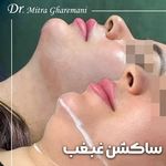 کلینیک زیبایی قهرمانی