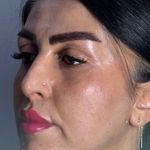 کلینیک زیبایی قهرمانی