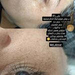 خدمات پاکسازی زیبایی و درمانی خضری پور