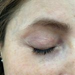 مرکز لیزر و زیبایی دکتر یعقوب اصفهانی