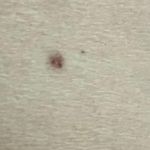 مرکز لیزر و زیبایی دکتر یعقوب اصفهانی