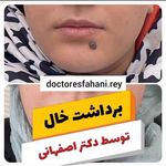 مرکز لیزر و زیبایی دکتر یعقوب اصفهانی