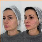 کلینیک پوست و زیبایی ژیلاوَش