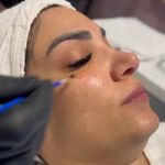 خدمات پاکسازی و فیشال پوست سحر