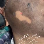 کلینیک لیزر و زیبایی الیزه اهواز