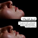 کلینیک لیزر و زیبایی مهسان