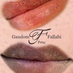 آرایش دائم وریموو تراپی پوست گندم فلاحی