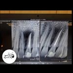 کلینیک دندان پزشکی و ایمپلنت الیسو