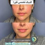 مجموعه زیبایی فلورا پوست مو زیبایی