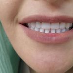 لابراتوار دندانسازی نیودنت