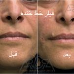 مرکز لیزر و زیبایی آرورا