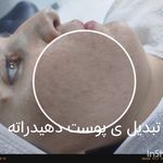درمانگر پوست سر و صورت
