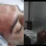 درمانگر پوست سر و صورت