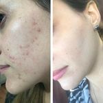 خدمات فیشیال صورت  نرگس