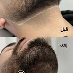 مطب لیزر و پوست و مو سابرینا شعبه نارمک