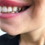 مرکز دندانپزشکی و دندانسازی اشراق