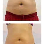 کلینیک لاغری صفاری