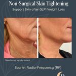 کلینیک زیبایی و لاغری زیباترشو