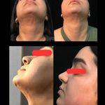 کلینیک زیبایی و لاغری زیباترشو