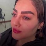 مطب پوست و لیزر