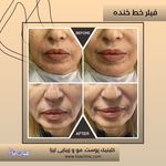 مطب پوست مو زیبایی فردوس شرق