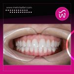 دکتر مهری صفری متخصص دندان پزشکی ترمیمی و زیبایی